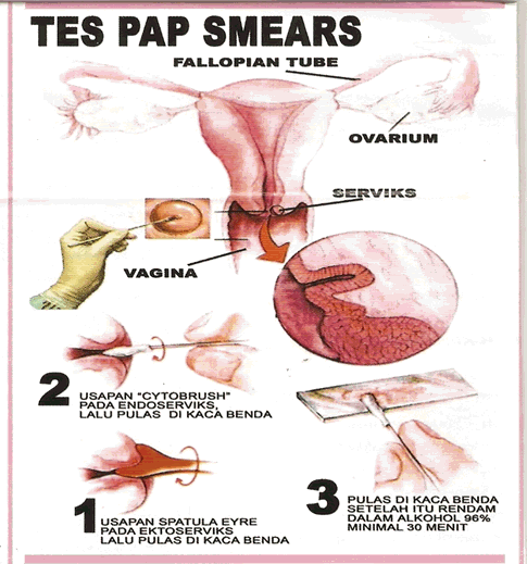 Pap Smears